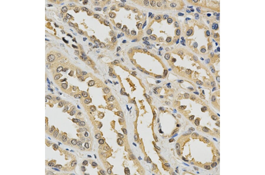 Immunohistochemistry - PDGFRB Antibody from Signalway Antibody (32646) - Antibodies.com