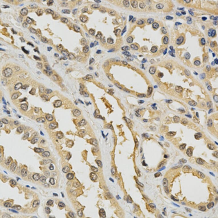 Immunohistochemistry - PDGFRB Antibody from Signalway Antibody (32646) - Antibodies.com