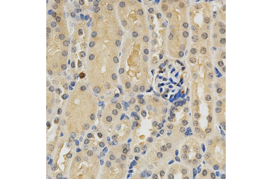 Immunohistochemistry - PDGFRB Antibody from Signalway Antibody (32646) - Antibodies.com