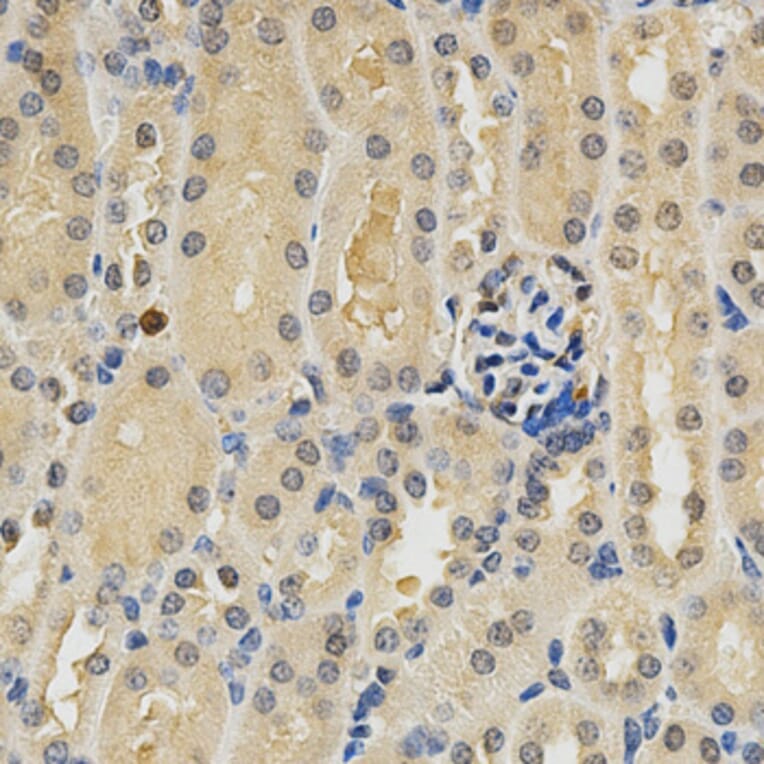Immunohistochemistry - PDGFRB Antibody from Signalway Antibody (32646) - Antibodies.com