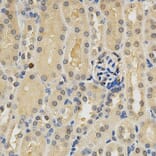 Immunohistochemistry - PDGFRB Antibody from Signalway Antibody (32646) - Antibodies.com