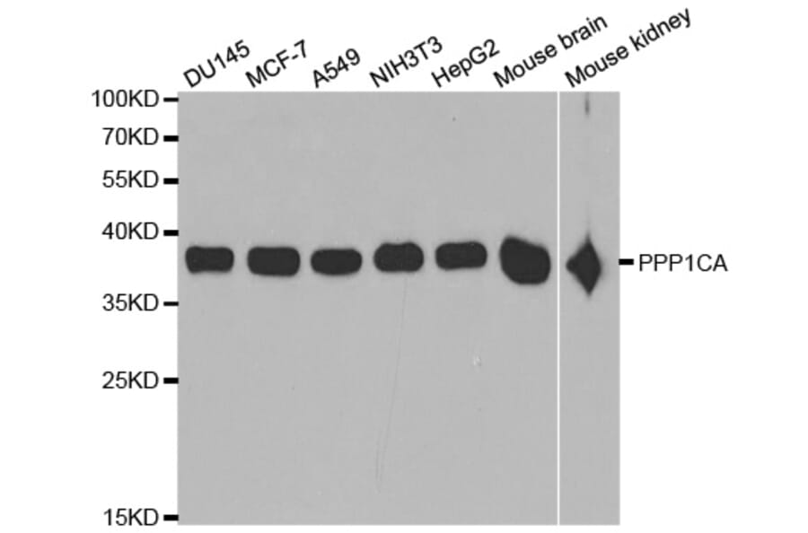 Western blot - PPP1CA Antibody from Signalway Antibody (32649) - Antibodies.com