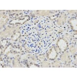 Immunohistochemistry - PPP1CA Antibody from Signalway Antibody (32649) - Antibodies.com