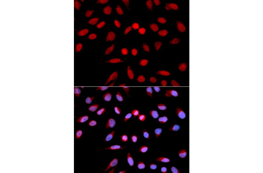 Immunofluorescence - PPP1CA Antibody from Signalway Antibody (32649) - Antibodies.com