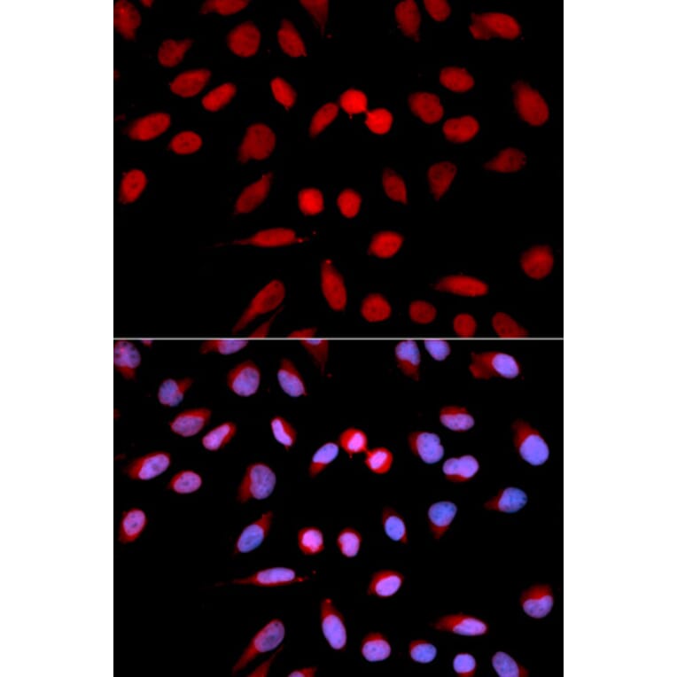 Immunofluorescence - PPP1CA Antibody from Signalway Antibody (32649) - Antibodies.com