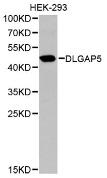 Western blot analysis of extracts of HEK-293 cell lines, using DLGAP5 antibody.