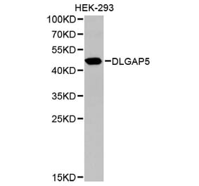 Western blot - DLGAP5 Antibody from Signalway Antibody (32659) - Antibodies.com