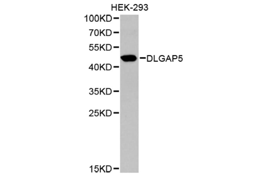 Western blot - DLGAP5 Antibody from Signalway Antibody (32659) - Antibodies.com