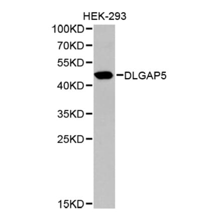Western blot - DLGAP5 Antibody from Signalway Antibody (32659) - Antibodies.com