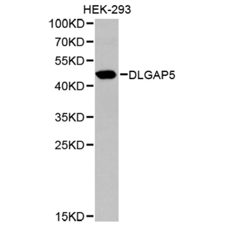 Western blot - DLGAP5 Antibody from Signalway Antibody (32659) - Antibodies.com