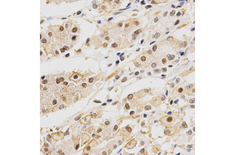 Immunohistochemistry - DLGAP5 Antibody from Signalway Antibody (32659) - Antibodies.com
