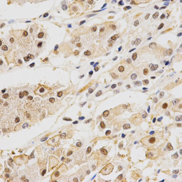 Immunohistochemistry - DLGAP5 Antibody from Signalway Antibody (32659) - Antibodies.com