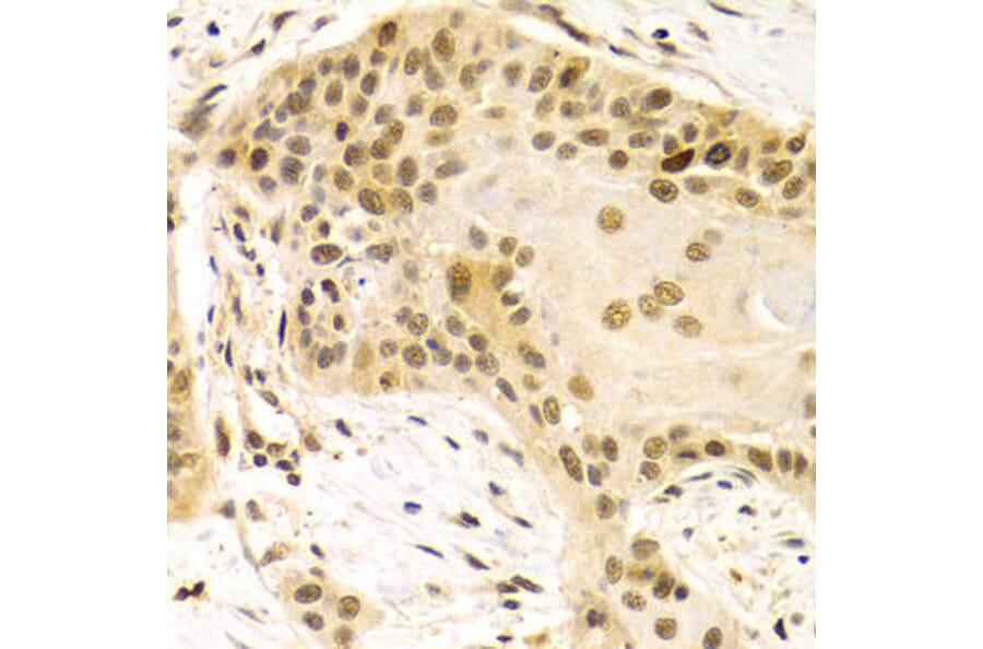 Immunohistochemistry - DLGAP5 Antibody from Signalway Antibody (32659) - Antibodies.com