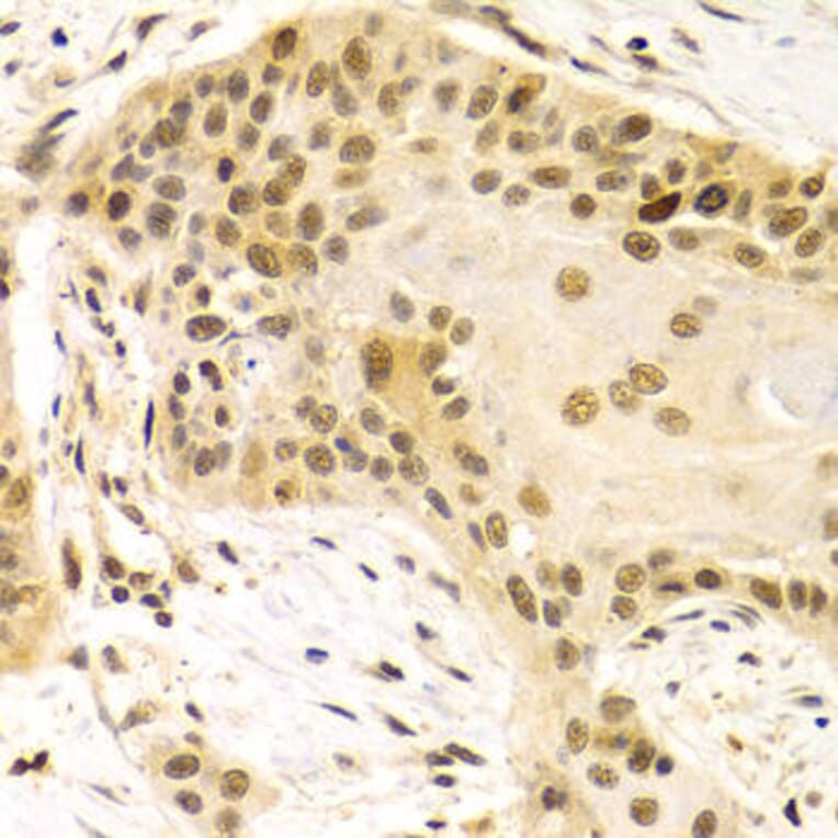 Immunohistochemistry - DLGAP5 Antibody from Signalway Antibody (32659) - Antibodies.com