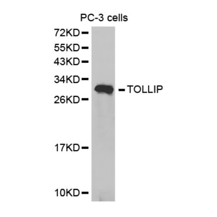 Western blot - TOLLIP Antibody from Signalway Antibody (32664) - Antibodies.com