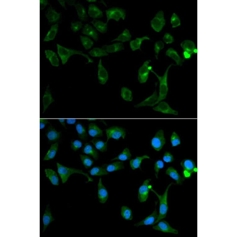 Immunofluorescence - TOLLIP Antibody from Signalway Antibody (32664) - Antibodies.com