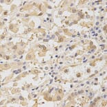 Immunohistochemistry - TOLLIP Antibody from Signalway Antibody (32664) - Antibodies.com