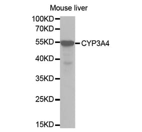 Western blot - CYP3A4 Antibody from Signalway Antibody (32703) - Antibodies.com