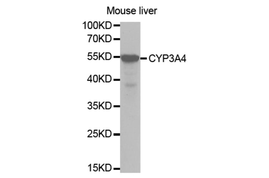 Western blot - CYP3A4 Antibody from Signalway Antibody (32703) - Antibodies.com