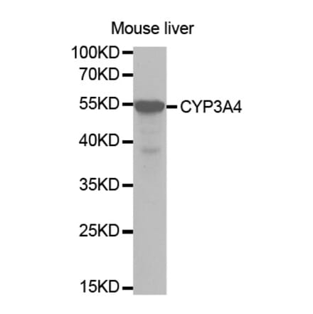 Western blot - CYP3A4 Antibody from Signalway Antibody (32703) - Antibodies.com