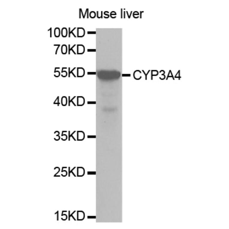 Western blot - CYP3A4 Antibody from Signalway Antibody (32703) - Antibodies.com