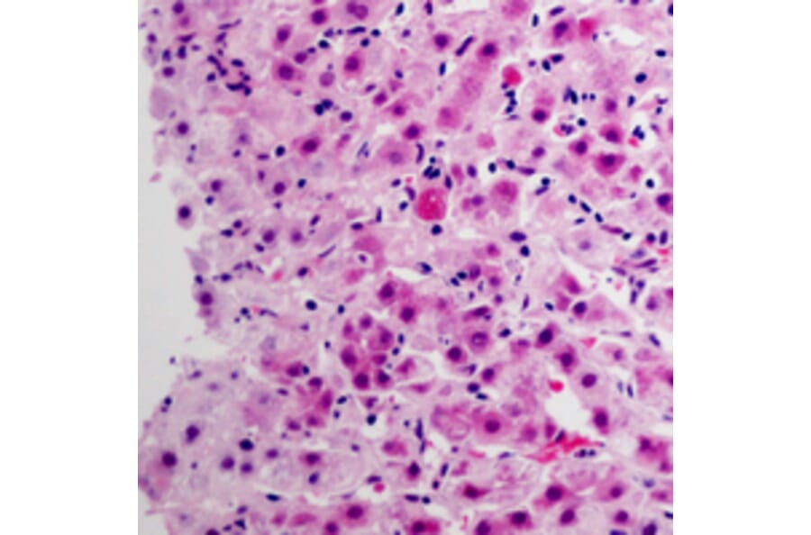 Immunohistochemistry - CYP3A4 Antibody from Signalway Antibody (32703) - Antibodies.com
