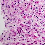 Immunohistochemistry - CYP3A4 Antibody from Signalway Antibody (32703) - Antibodies.com