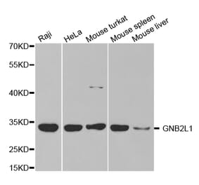 Western blot - GNB2L1 Antibody from Signalway Antibody (32713) - Antibodies.com