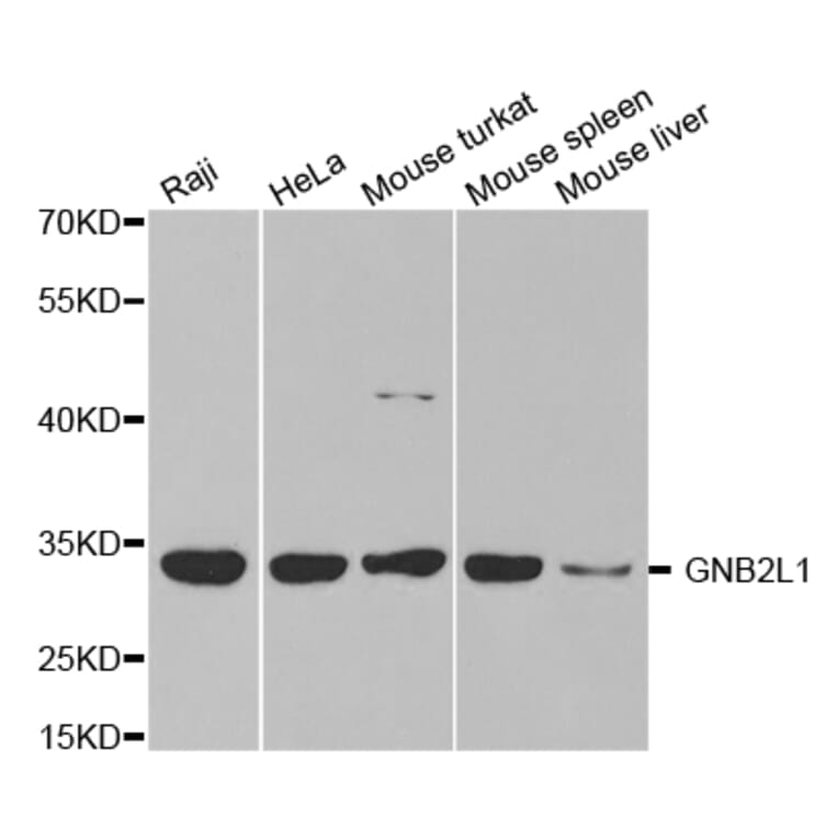 Western blot - GNB2L1 Antibody from Signalway Antibody (32713) - Antibodies.com