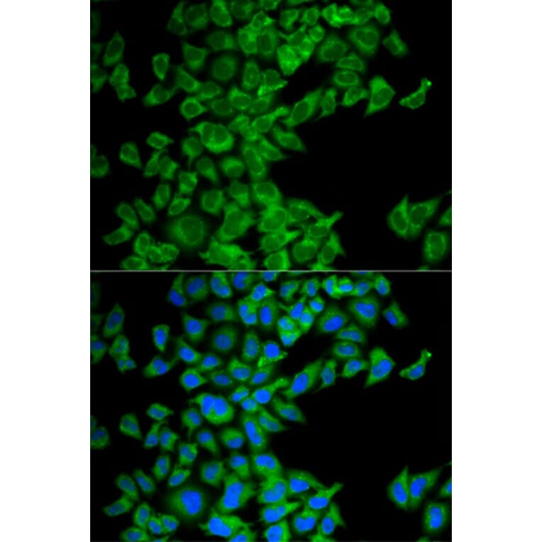Immunofluorescence - DIABLO Antibody from Signalway Antibody (32716) - Antibodies.com