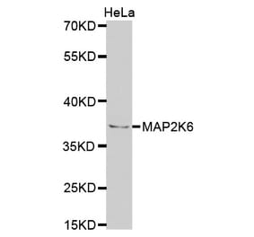 Western blot - MAP2K6 Antibody from Signalway Antibody (32725) - Antibodies.com