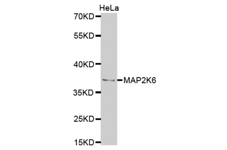 Western blot - MAP2K6 Antibody from Signalway Antibody (32725) - Antibodies.com