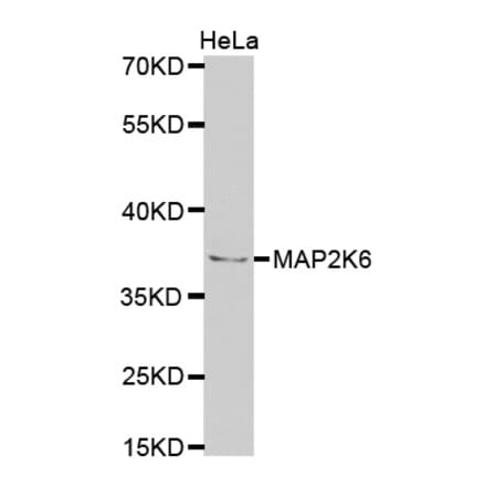 Western blot - MAP2K6 Antibody from Signalway Antibody (32725) - Antibodies.com