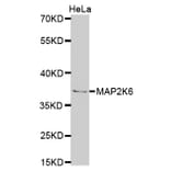 Western blot - MAP2K6 Antibody from Signalway Antibody (32725) - Antibodies.com
