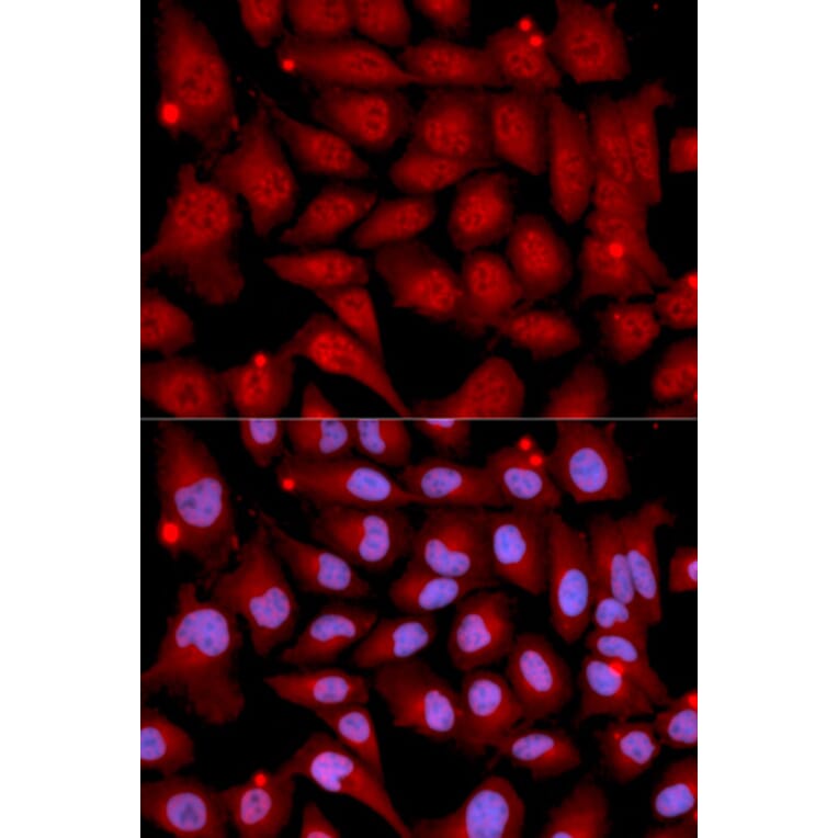 Immunofluorescence - MAP2K6 Antibody from Signalway Antibody (32725) - Antibodies.com