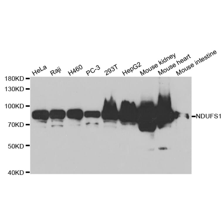 Western blot - NDUFS1 Antibody from Signalway Antibody (32739) - Antibodies.com