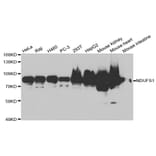 Western blot - NDUFS1 Antibody from Signalway Antibody (32739) - Antibodies.com