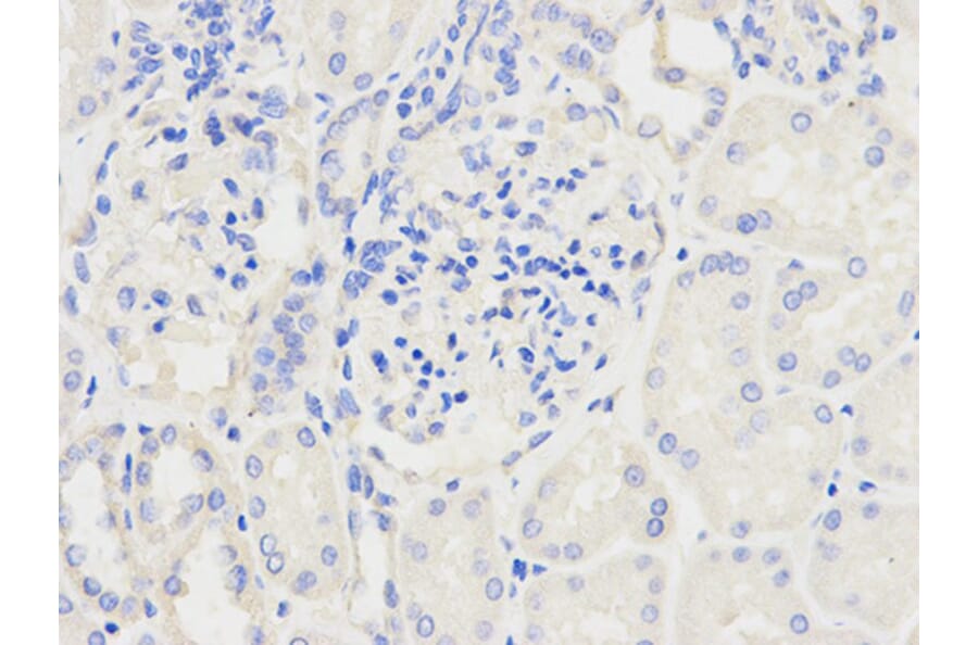 Immunohistochemistry - NDUFS1 Antibody from Signalway Antibody (32739) - Antibodies.com