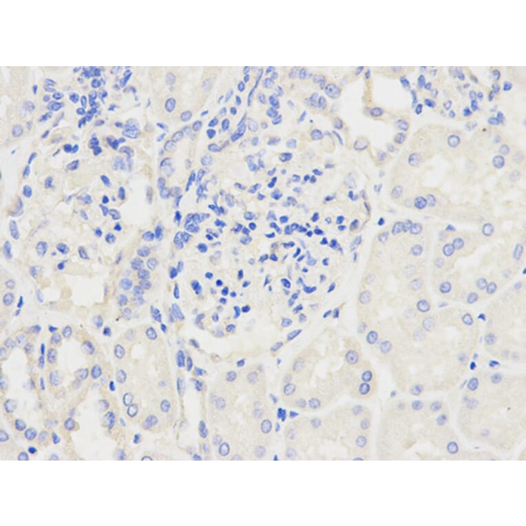 Immunohistochemistry - NDUFS1 Antibody from Signalway Antibody (32739) - Antibodies.com