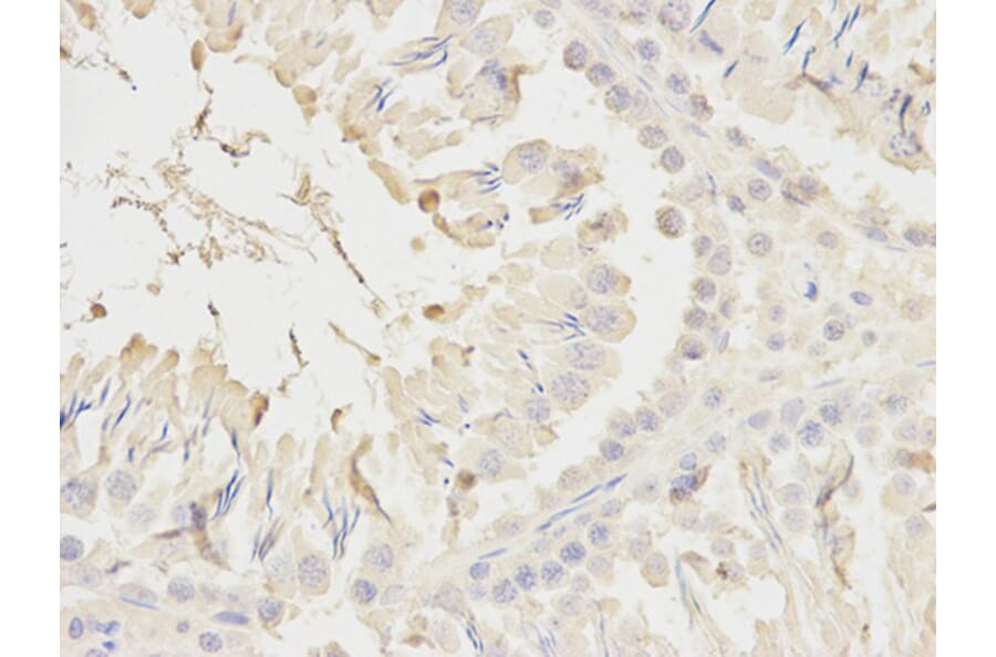 Immunohistochemistry - NDUFS1 Antibody from Signalway Antibody (32739) - Antibodies.com