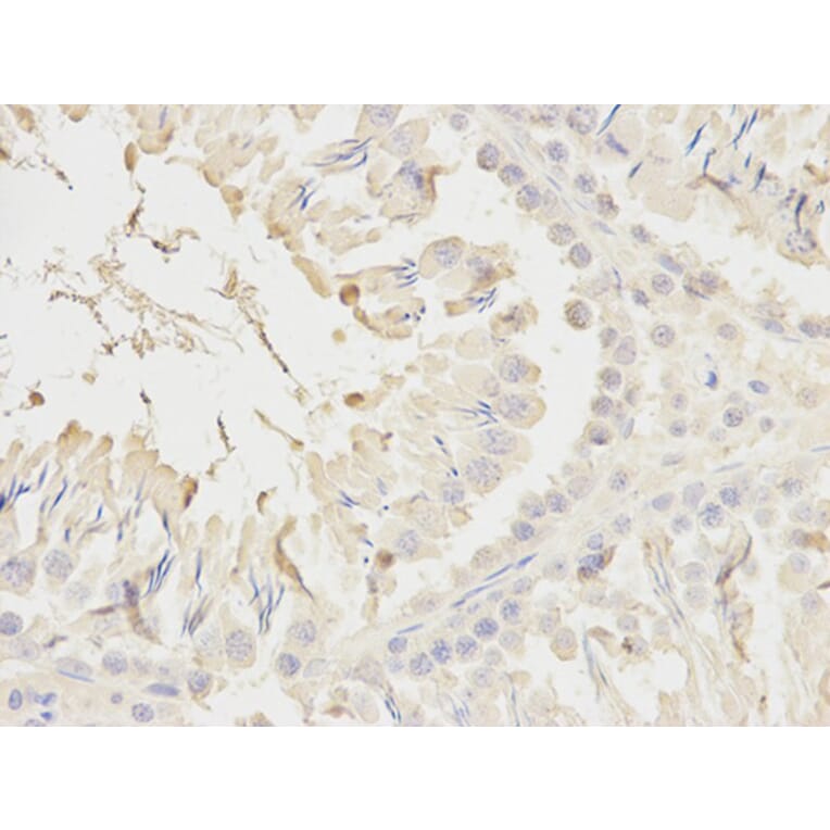 Immunohistochemistry - NDUFS1 Antibody from Signalway Antibody (32739) - Antibodies.com