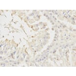 Immunohistochemistry - NDUFS1 Antibody from Signalway Antibody (32739) - Antibodies.com