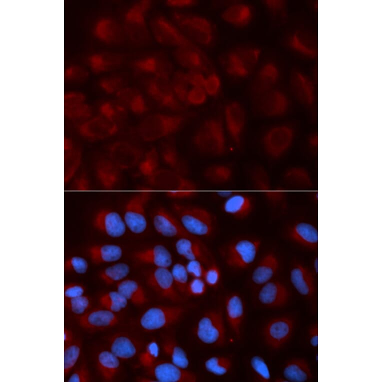 Immunofluorescence - NDUFS1 Antibody from Signalway Antibody (32739) - Antibodies.com