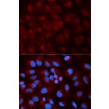 Immunofluorescence - NDUFS1 Antibody from Signalway Antibody (32739) - Antibodies.com