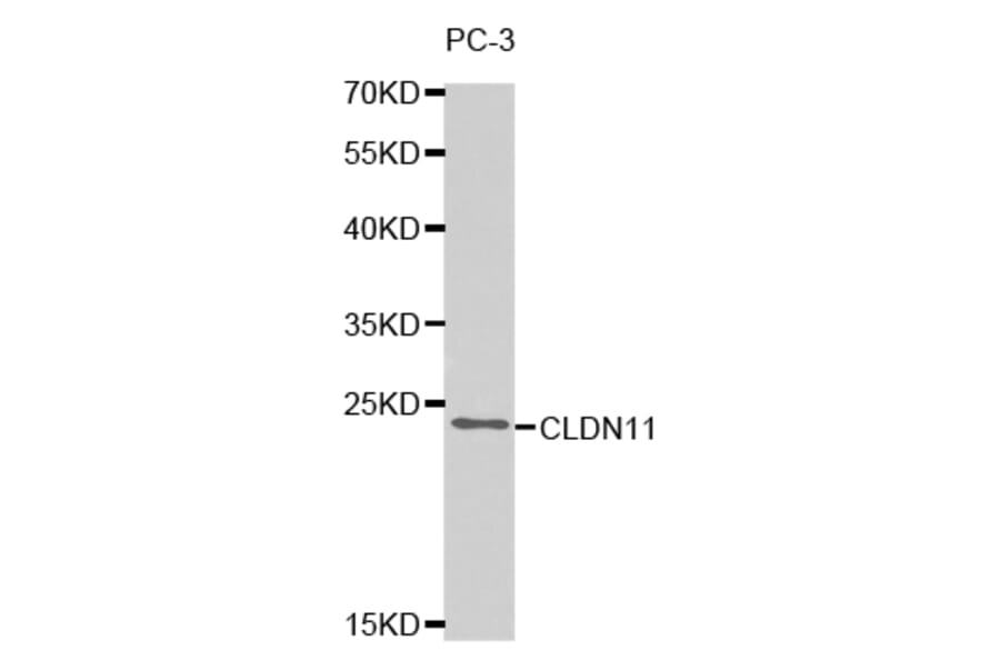 Western blot - CLDN11 Antibody from Signalway Antibody (32740) - Antibodies.com