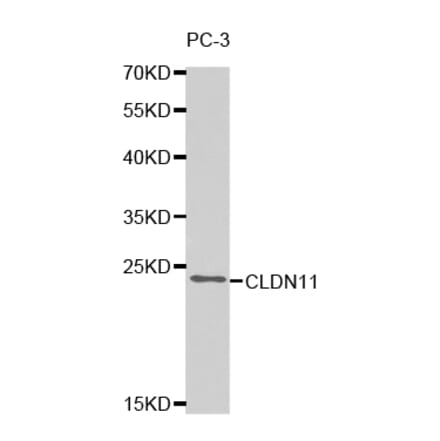 Western blot - CLDN11 Antibody from Signalway Antibody (32740) - Antibodies.com