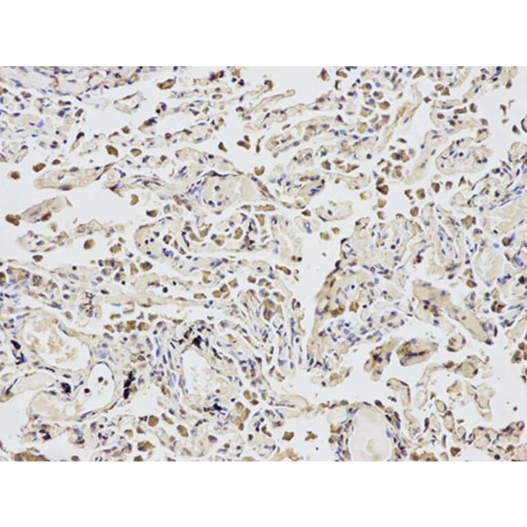 Immunohistochemistry - EIF4A1 Antibody from Signalway Antibody (32748) - Antibodies.com