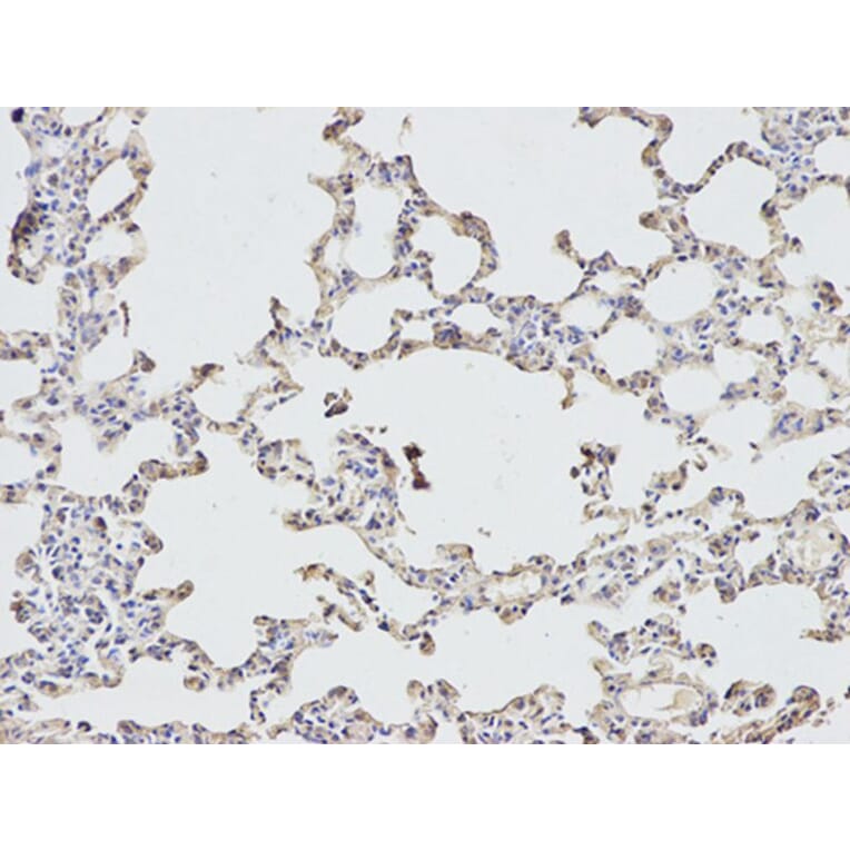 Immunohistochemistry - EIF4A1 Antibody from Signalway Antibody (32748) - Antibodies.com