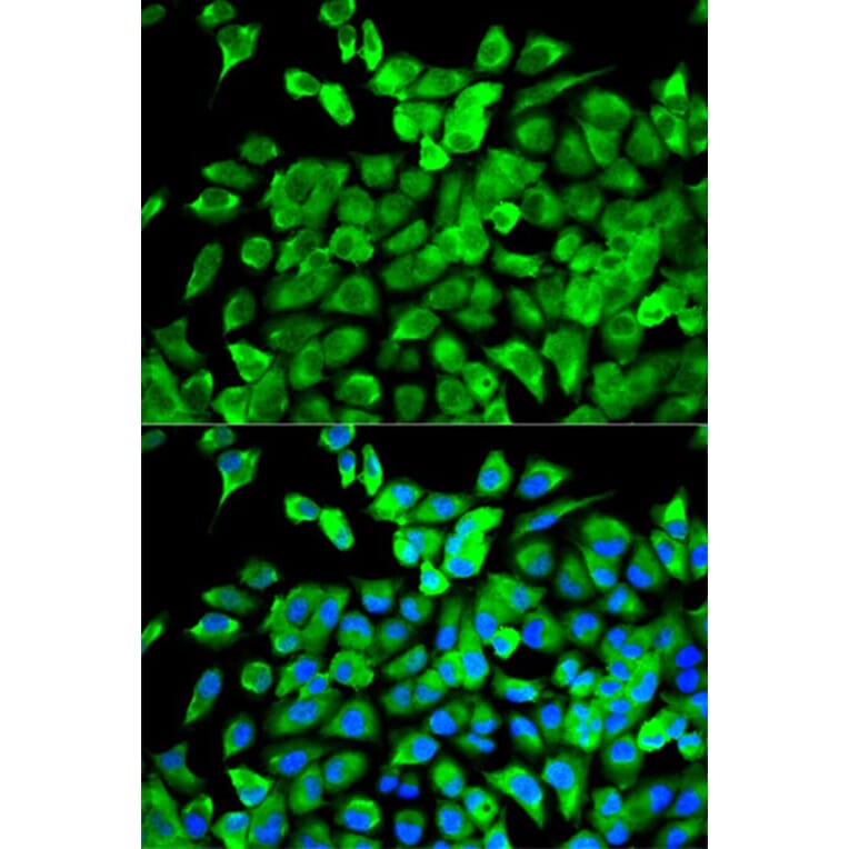 Immunofluorescence - EIF4A1 Antibody from Signalway Antibody (32748) - Antibodies.com