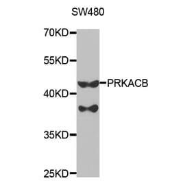 Western blot - PRKACB Antibody from Signalway Antibody (32772) - Antibodies.com
